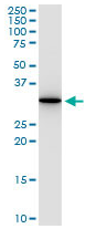 Human ANXA5 Monoclonal Antibody