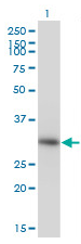 Human ANXA4 Monoclonal Antibody