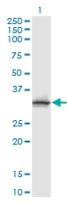 Human ASRGL1 Monoclonal Antibody