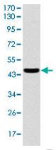 Human ASS1 Monoclonal Antibody