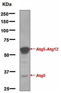 Human ATG5 Monoclonal Antibody