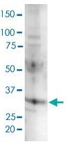 Human CCND3 Monoclonal Antibody