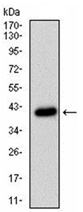 Human CD36 Monoclonal Antibody