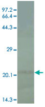 Human IL18 Monoclonal Antibody