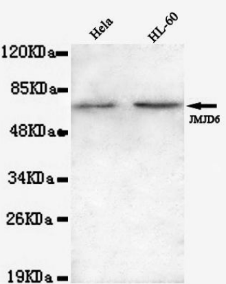 Human JMJD6 Monoclonal Antibody