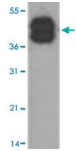 Human KRT10 Monoclonal Antibody