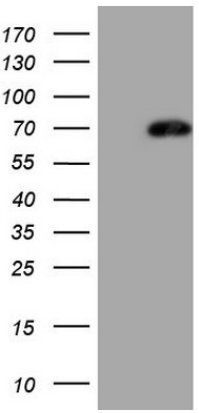 Human LAG3 Monoclonal Antibody