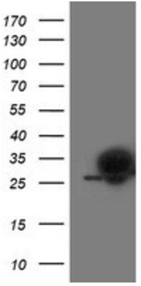 Human PGAM2 Monoclonal Antibody