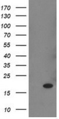 Human RBP1 Monoclonal Antibody