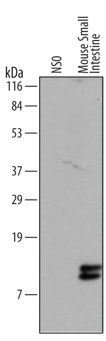 Human REG1B Monoclonal Antibody