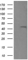 Human RNF39 Monoclonal Antibody