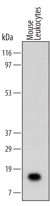 Human S100A8 Monoclonal Antibody