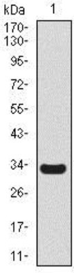Human SCGB1A1 Monoclonal Antibody
