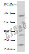 Human ADAD1 Polyclonal Antibody
