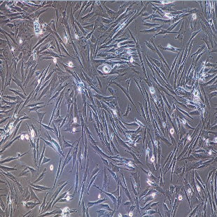 人原代胎盘间充质干细胞