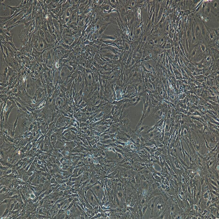 小鼠原代肝窦内皮细胞