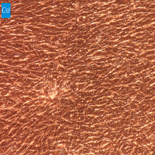 兔原代淋巴管成纤维细胞