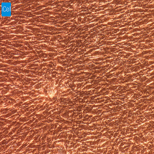 兔原代脉络膜成纤维细胞