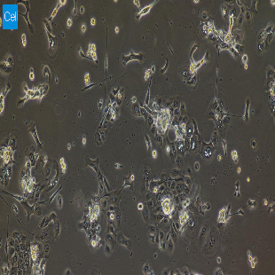 大鼠原代晶状体上皮细胞