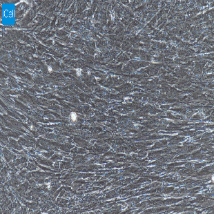 大鼠原代结膜成纤维细胞