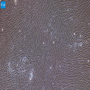 大鼠原代输尿管平滑肌细胞