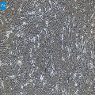小鼠原代子宫平滑肌细胞