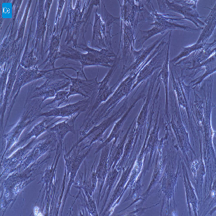 小鼠原代脉络膜成纤维细胞