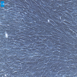 大鼠原代肺大动脉外膜成纤维细胞