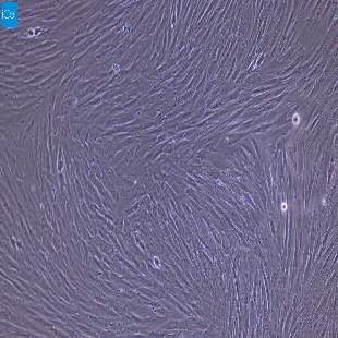 大鼠原代心肌成纤维细胞
