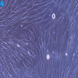 大鼠原代心肌成纤维细胞