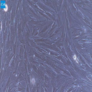 大鼠原代主动脉外膜成纤维细胞
