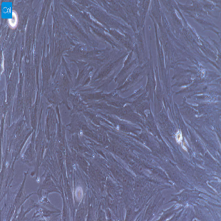 大鼠原代腹腔主动脉外膜成纤维细胞