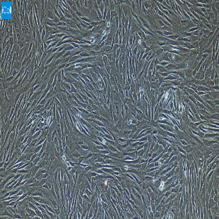 小鼠原代肺大动脉外膜成纤维细胞