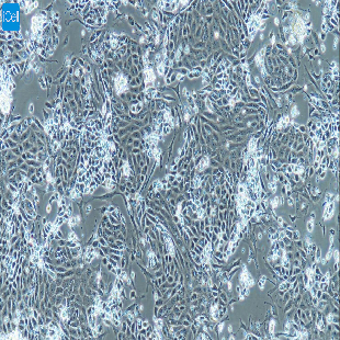 小鼠原代Ⅱ型肺泡上皮细胞