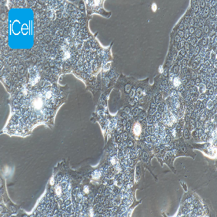 Capan-1 人胰腺癌细胞