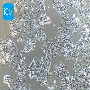 Capan-1 人胰腺癌细胞
