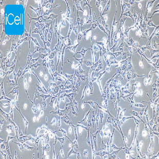 D407 人视网膜色素上皮细胞（暂不提供）