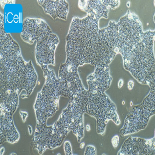 NCI-N87 人胃癌细胞