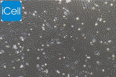 大鼠原代胰腺星状细胞