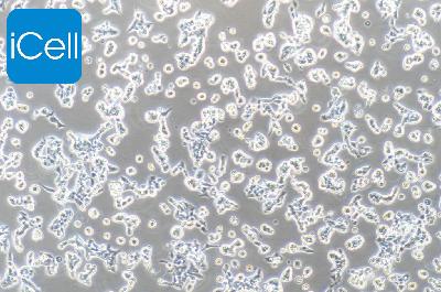 RL95-2 人子宫内膜癌细胞