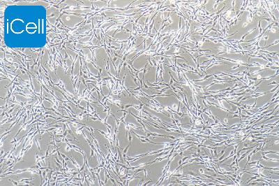 PC-12高分化 大鼠肾上腺嗜铬细胞瘤细胞 高分化 