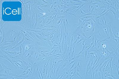 SW-1353 人骨肉瘤细胞
