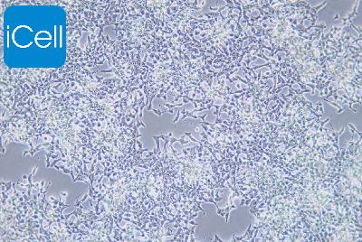 INS-1 大鼠胰岛细胞瘤细胞