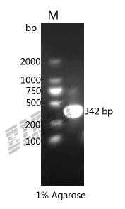 Human HMGB2 Protein