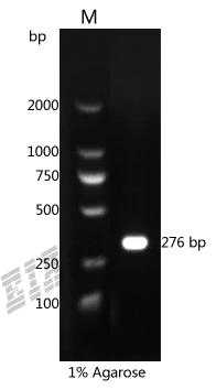 Human S100B Protein