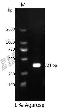 Human NPPB Protein