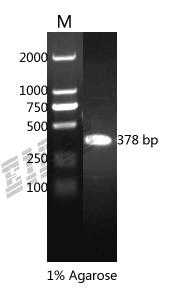 Human HSPA1A Protein