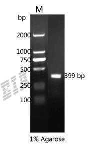 Human FABP3 Protein