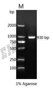 Human IL1RL1 Protein