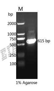 Human HSPB1 Protein